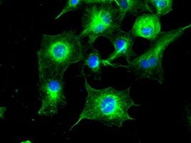 TUBA8 Antibody in Immunocytochemistry (ICC/IF)