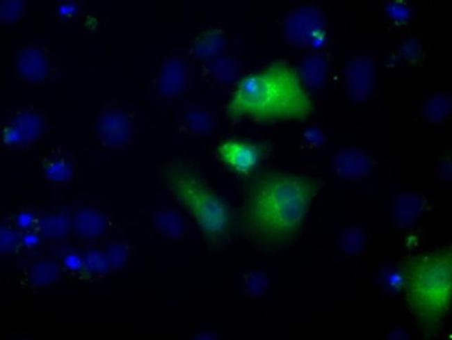 ALDH3A1 Antibody in Immunocytochemistry (ICC/IF)