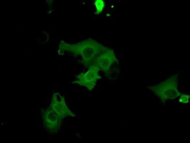 cGKI Antibody in Immunocytochemistry (ICC/IF)