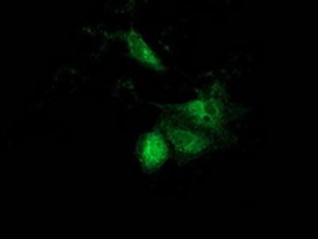 ACAT2 Antibody in Immunocytochemistry (ICC/IF)