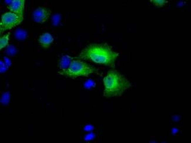 BDH2 Antibody in Immunocytochemistry (ICC/IF)