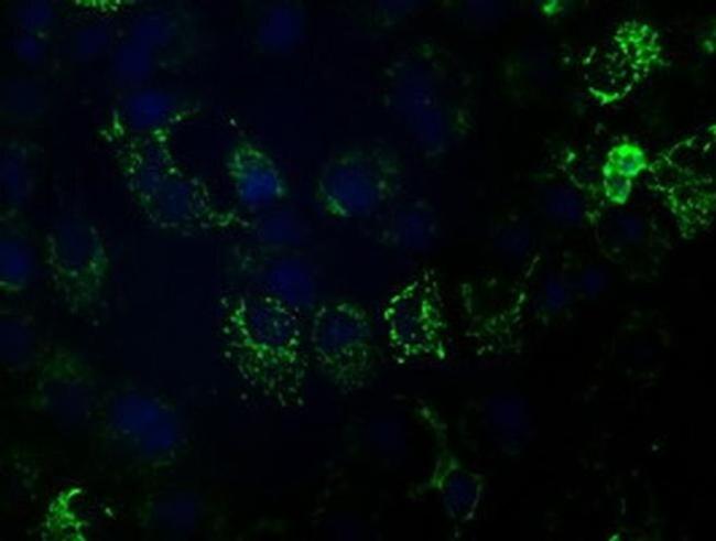 HIBCH Antibody in Immunocytochemistry (ICC/IF)