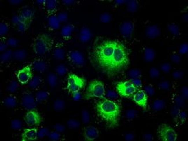 Thromboxane synthase Antibody in Immunocytochemistry (ICC/IF)