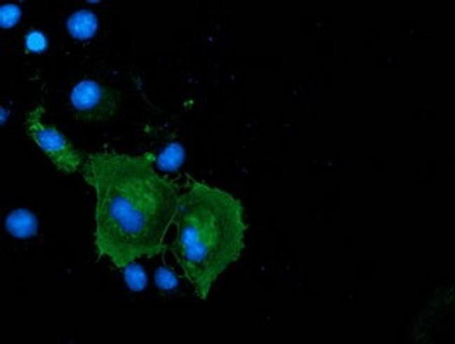 Coronin 1A Antibody in Immunocytochemistry (ICC/IF)