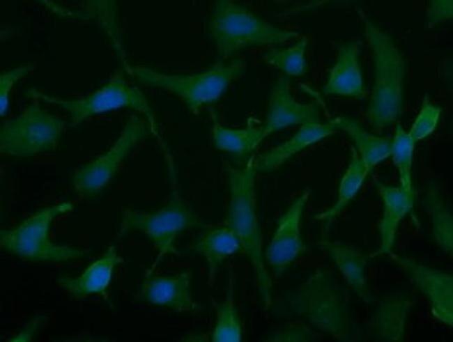 UCK1 Antibody in Immunocytochemistry (ICC/IF)