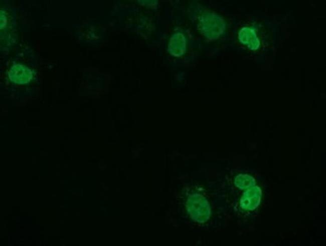 UCK1 Antibody in Immunocytochemistry (ICC/IF)