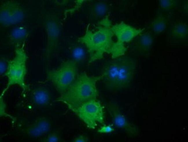 Coronin 1B Antibody in Immunocytochemistry (ICC/IF)