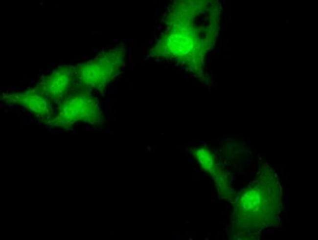 NSE2 Antibody in Immunocytochemistry (ICC/IF)