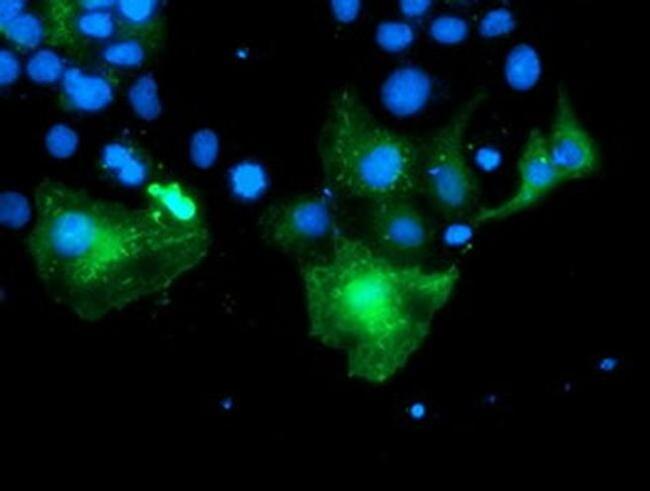 PECR Antibody in Immunocytochemistry (ICC/IF)