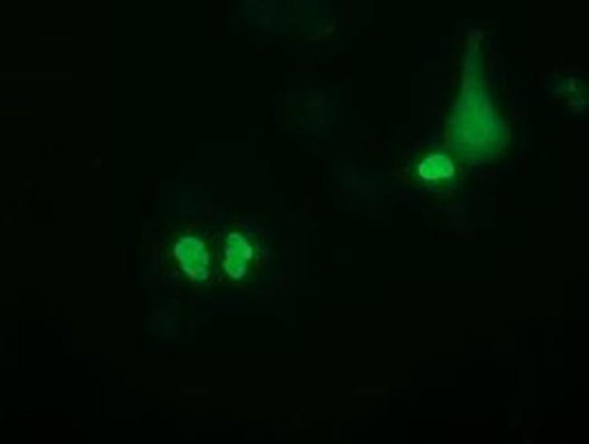 PUS7 Antibody in Immunocytochemistry (ICC/IF)