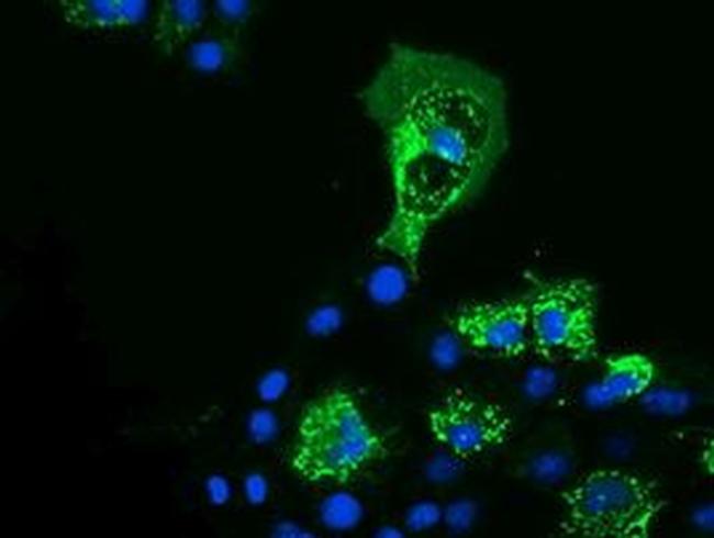 PYCR2 Antibody in Immunocytochemistry (ICC/IF)