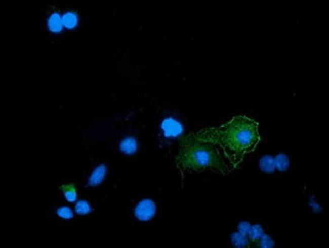 BIN3 Antibody in Immunocytochemistry (ICC/IF)