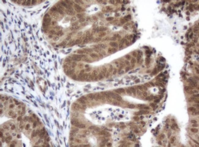 ZIM2 Antibody in Immunohistochemistry (Paraffin) (IHC (P))