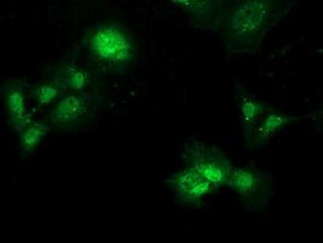 PBLD Antibody in Immunocytochemistry (ICC/IF)