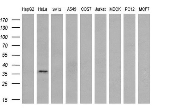 XLF Antibody in Western Blot (WB)