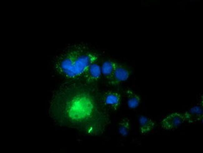 Syntrophin alpha-1 Antibody in Immunocytochemistry (ICC/IF)