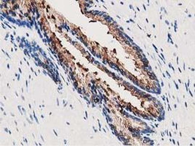 Annexin A3 Antibody in Immunohistochemistry (Paraffin) (IHC (P))