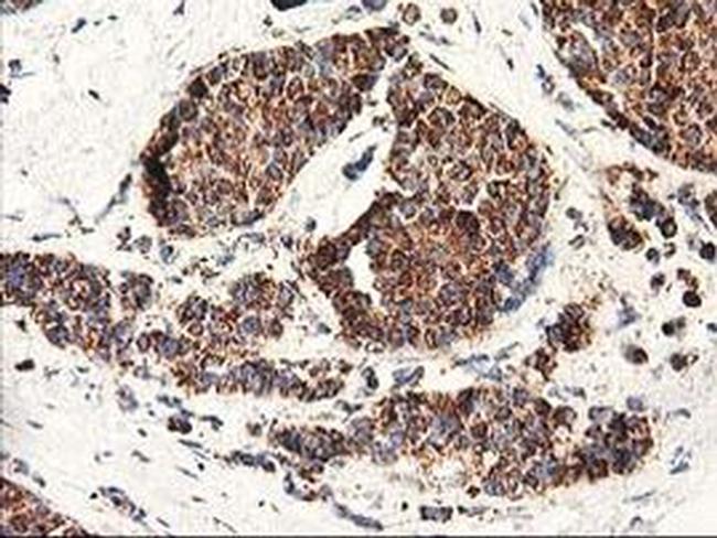 CLPP Antibody in Immunohistochemistry (Paraffin) (IHC (P))