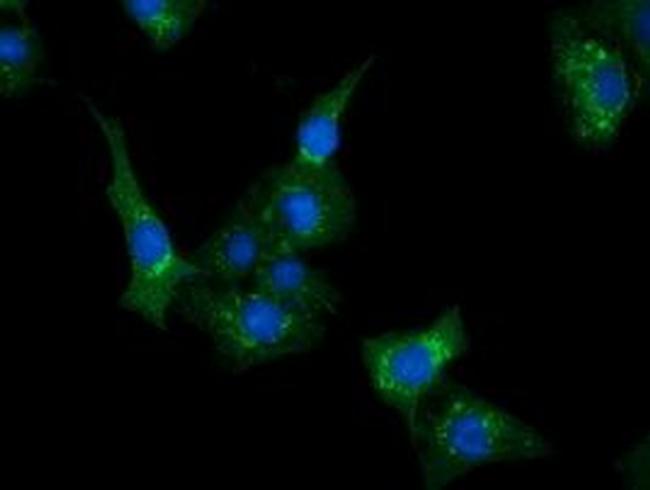 CLPP Antibody in Immunocytochemistry (ICC/IF)