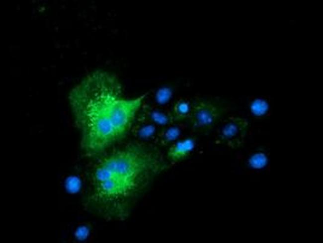 CLPP Antibody in Immunocytochemistry (ICC/IF)