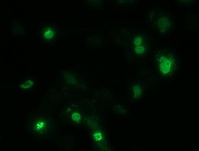 ZIM2 Antibody in Immunocytochemistry (ICC/IF)