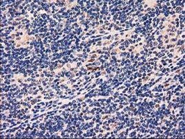 GRHPR Antibody in Immunohistochemistry (Paraffin) (IHC (P))