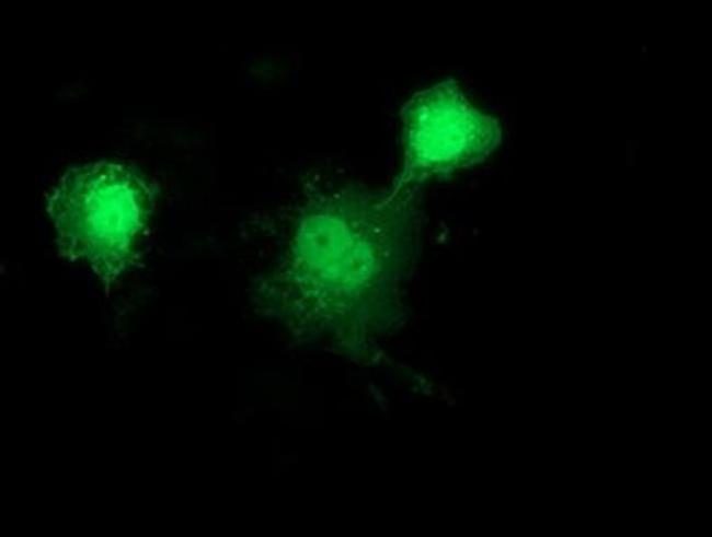 HSP40 Antibody in Immunocytochemistry (ICC/IF)