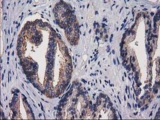 PACSIN3 Antibody in Immunohistochemistry (Paraffin) (IHC (P))