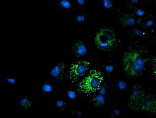 MMAA Antibody in Immunocytochemistry (ICC/IF)