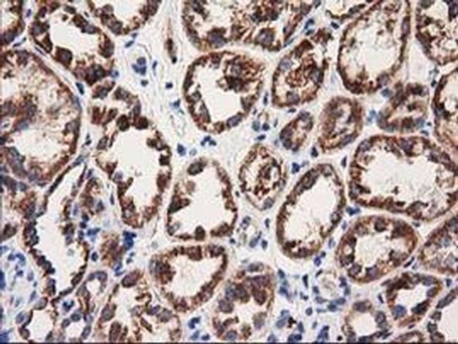 MMAA Antibody in Immunohistochemistry (Paraffin) (IHC (P))