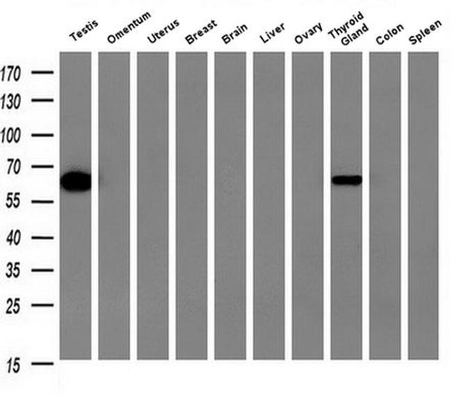 GBP5 Antibody in Western Blot (WB)