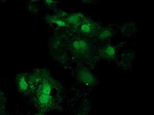 eIF4E2 Antibody in Immunocytochemistry (ICC/IF)