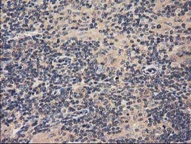 ACOT12 Antibody in Immunohistochemistry (Paraffin) (IHC (P))