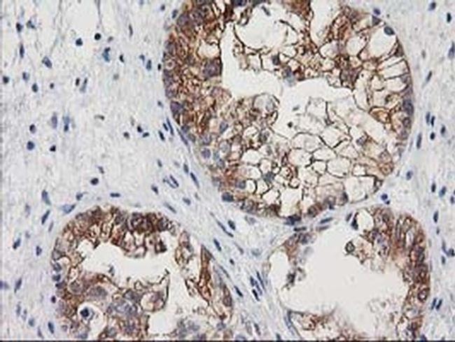 NNMT Antibody in Immunohistochemistry (Paraffin) (IHC (P))