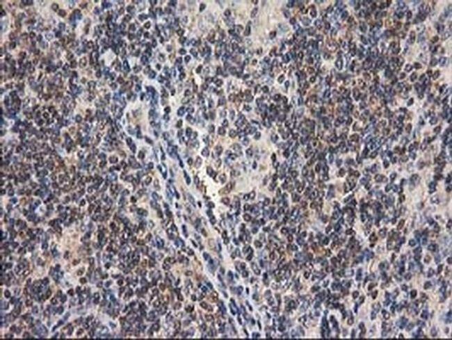 GBA3 Antibody in Immunohistochemistry (Paraffin) (IHC (P))