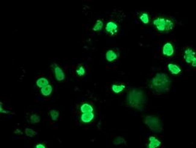 MEF2C Antibody in Immunocytochemistry (ICC/IF)