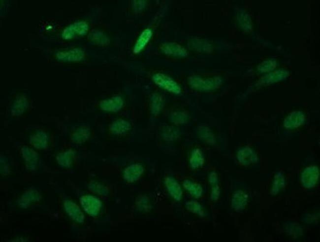 ECRG4 Antibody in Immunocytochemistry (ICC/IF)