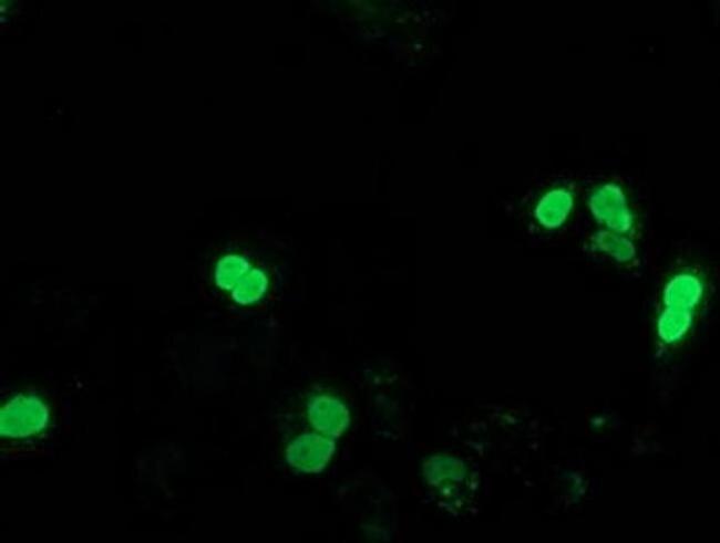 SSX1 Antibody in Immunocytochemistry (ICC/IF)