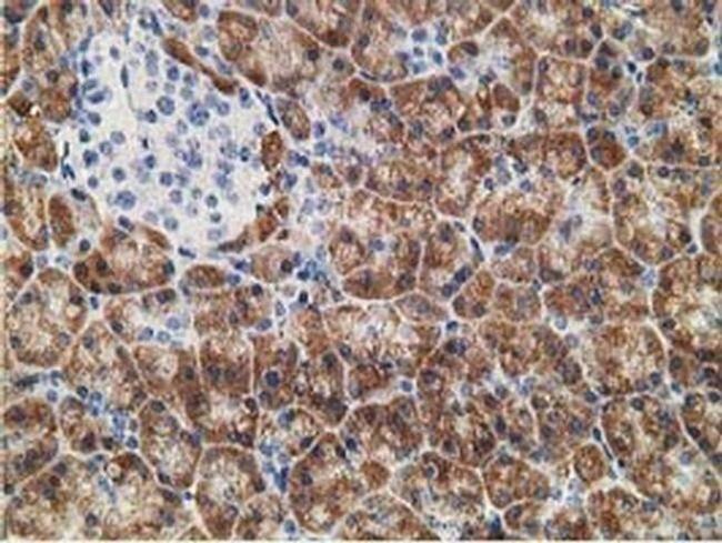 NDUFA7 Antibody in Immunohistochemistry (Paraffin) (IHC (P))