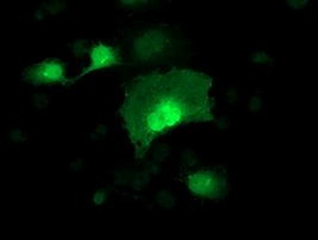 Alcohol Dehydrogenase 1B Antibody in Immunocytochemistry (ICC/IF)