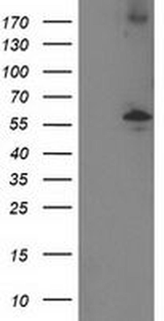 PPM1B Antibody in Western Blot (WB)