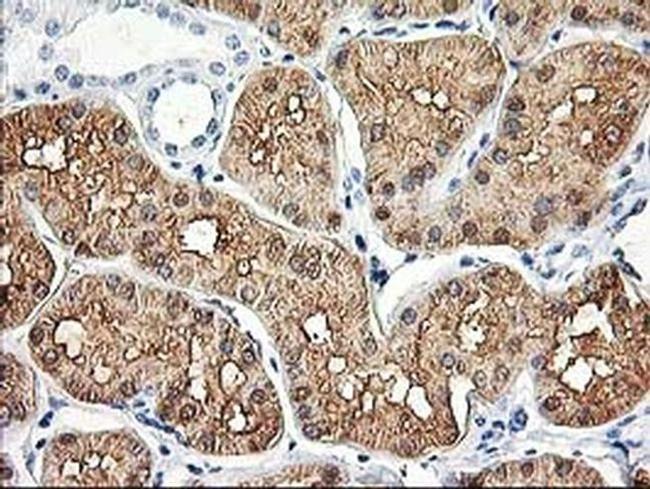 Aldolase B Antibody in Immunohistochemistry (Paraffin) (IHC (P))