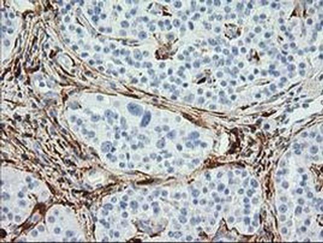 Alcohol Dehydrogenase 1B Antibody in Immunohistochemistry (Paraffin) (IHC (P))