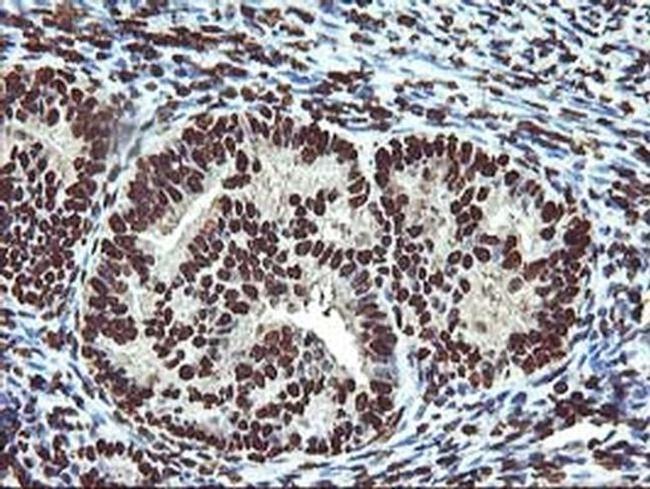 OSGEP Antibody in Immunohistochemistry (Paraffin) (IHC (P))