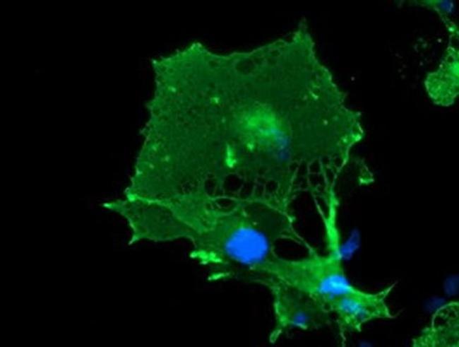 LIMK1 Antibody in Immunocytochemistry (ICC/IF)