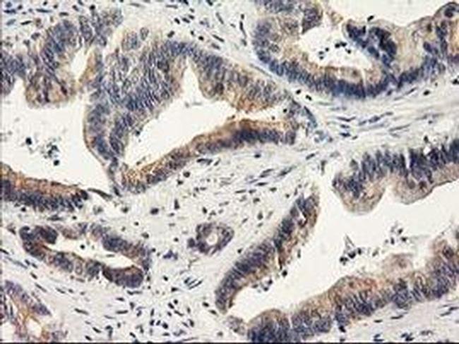 ILVBL Antibody in Immunohistochemistry (Paraffin) (IHC (P))