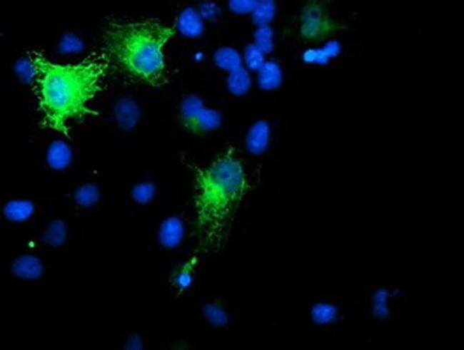 SMS Antibody in Immunocytochemistry (ICC/IF)