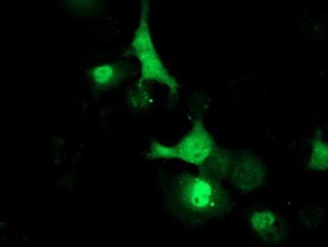 LCMT1 Antibody in Immunocytochemistry (ICC/IF)