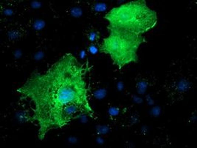 LMCD1 Antibody in Immunocytochemistry (ICC/IF)