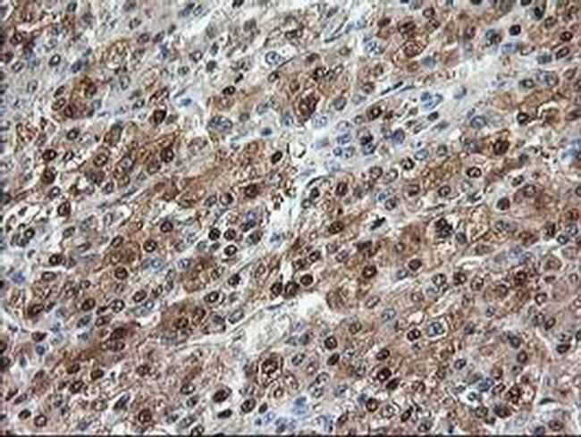 Aminoacylase Antibody in Immunohistochemistry (Paraffin) (IHC (P))